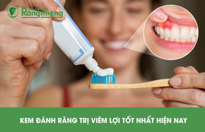 Kem Đánh Răng Trị Viêm Nướu: Giải Pháp Hiệu Quả Cho Nụ Cười Khỏe Mạnh