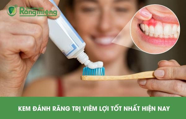 Tiêu Chí Lựa Chọn Kem Đánh Răng Trị Viêm Lợi