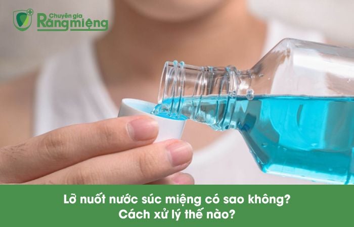 Lỡ nuốt nước súc miệng có sao không? Giải pháp và lưu ý quan trọng