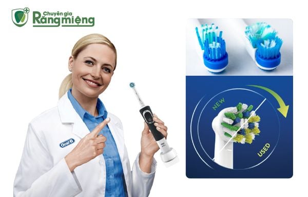 Bao lâu thì nên thay đầu bàn chải điện Oral B?