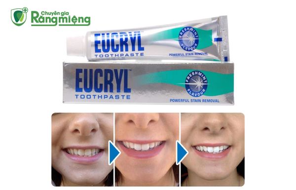 Công dụng kem đánh răng Eucryl