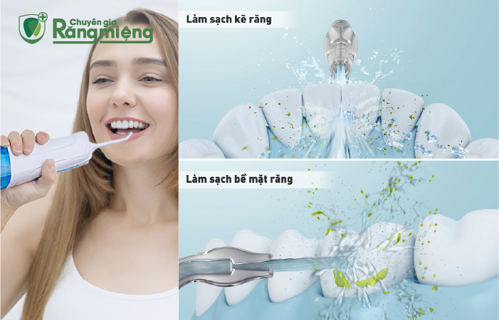 Máy tăm nước tạo ra các tia nước áp lực lớn để loại bỏ thức ăn