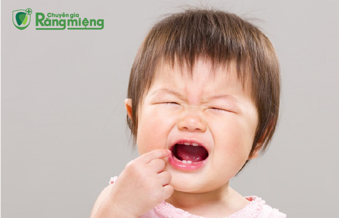 Triệu chứng và nguyên nhân dẫn đến lở miệng ở trẻ nhỏ