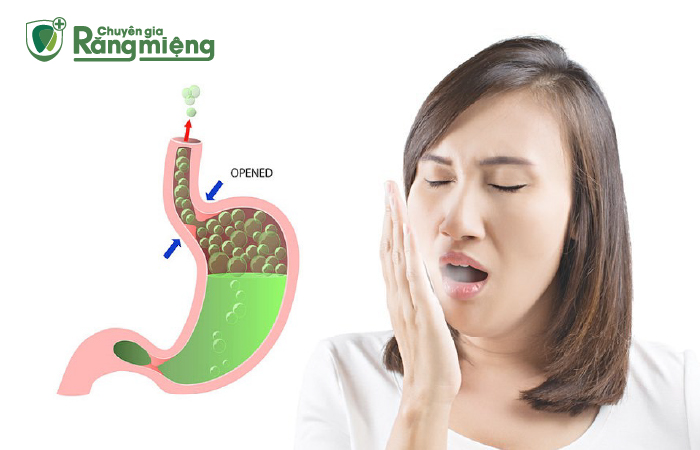 Các bệnh lý dạ dày ảnh hưởng tới tiêu hóa, gây trào ngược và sinh ra mùi hôi từ cổ họng