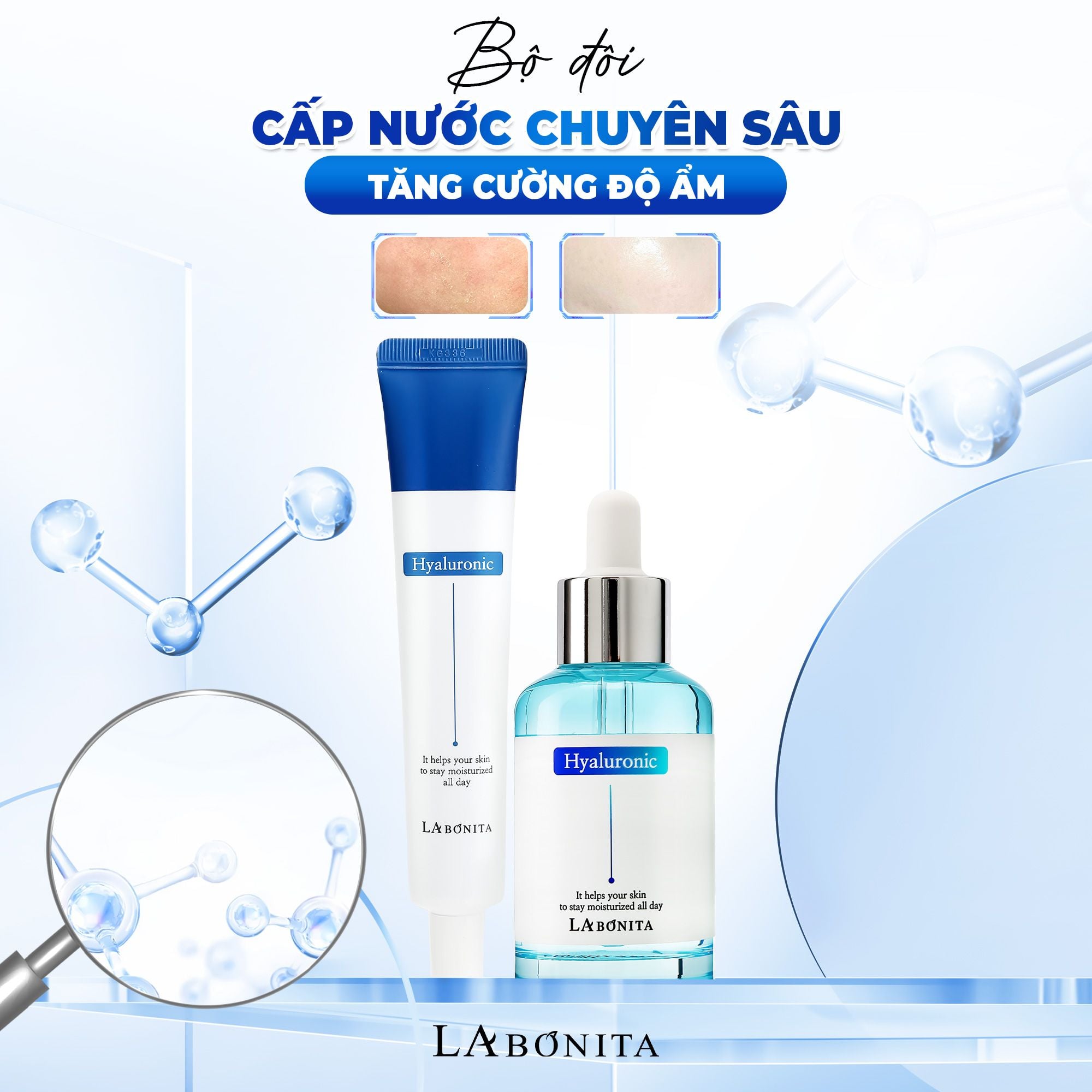 Review Bộ Đôi Cấp Ẩm - Cấp Nước Cho Làn Da Thời Tiết Chuyển Mùa