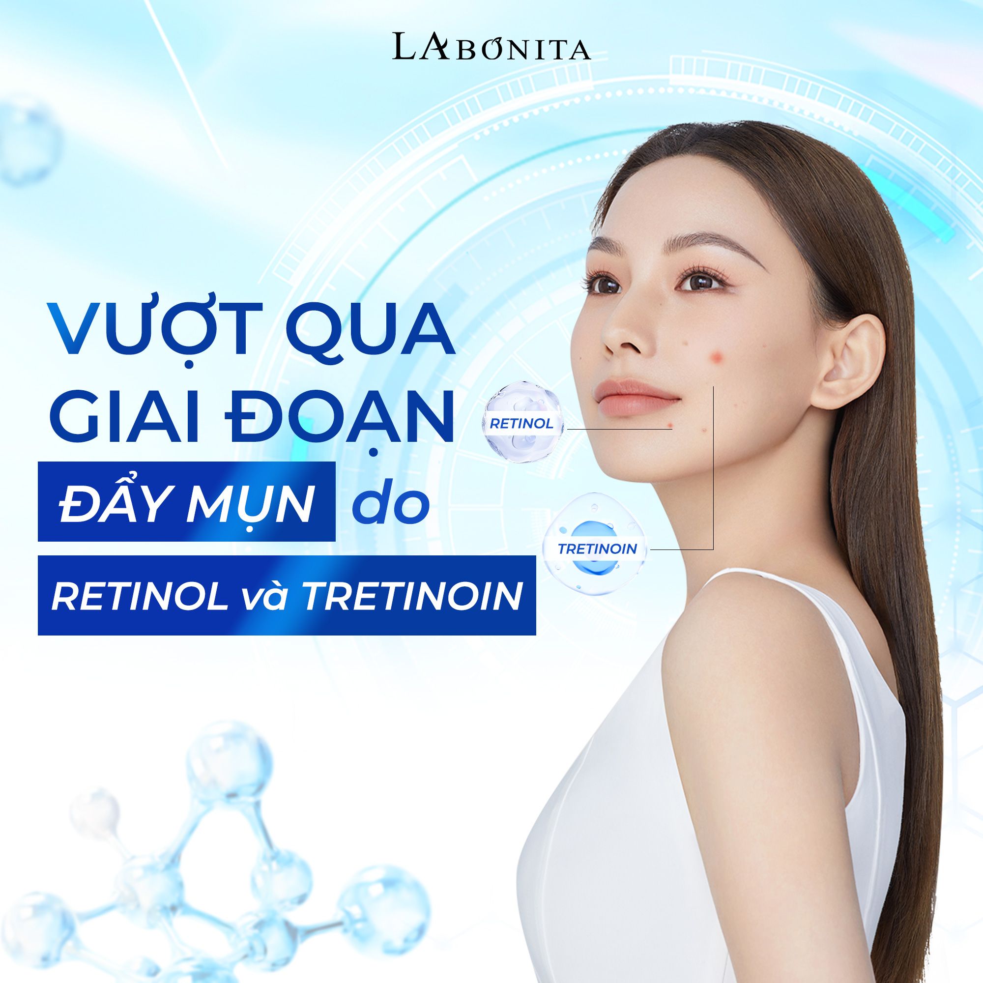 VƯỢT QUA GIAI ĐOẠN ĐẨY MỤN DO RETINOL & TRETINOIN