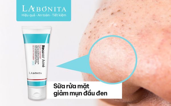 Sữa rửa mặt giảm mụn đầu đen hot nhất hiện nay