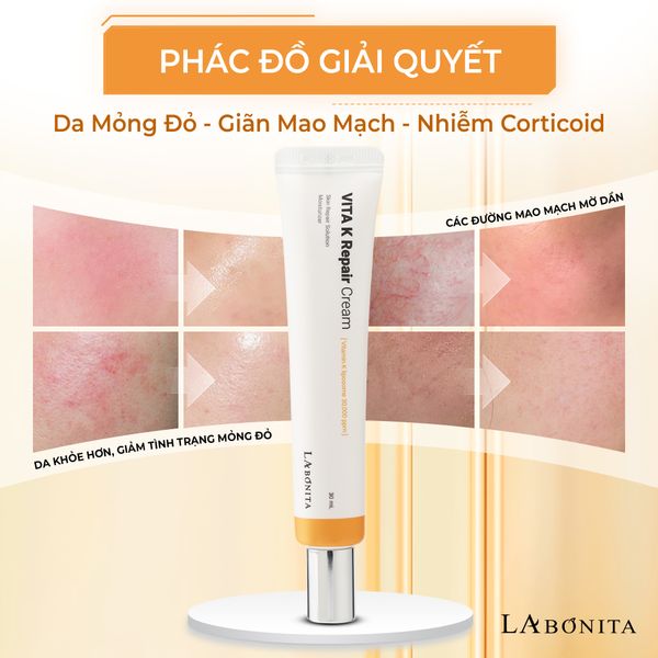 Review Chi tiết Kem dưỡng Vitamin K từ La Bonita: GIẢI PHÁP HIỆU QUẢ PHỤC HỒI DA, GIẢM MỎNG ĐỎ, MỜ THÂM