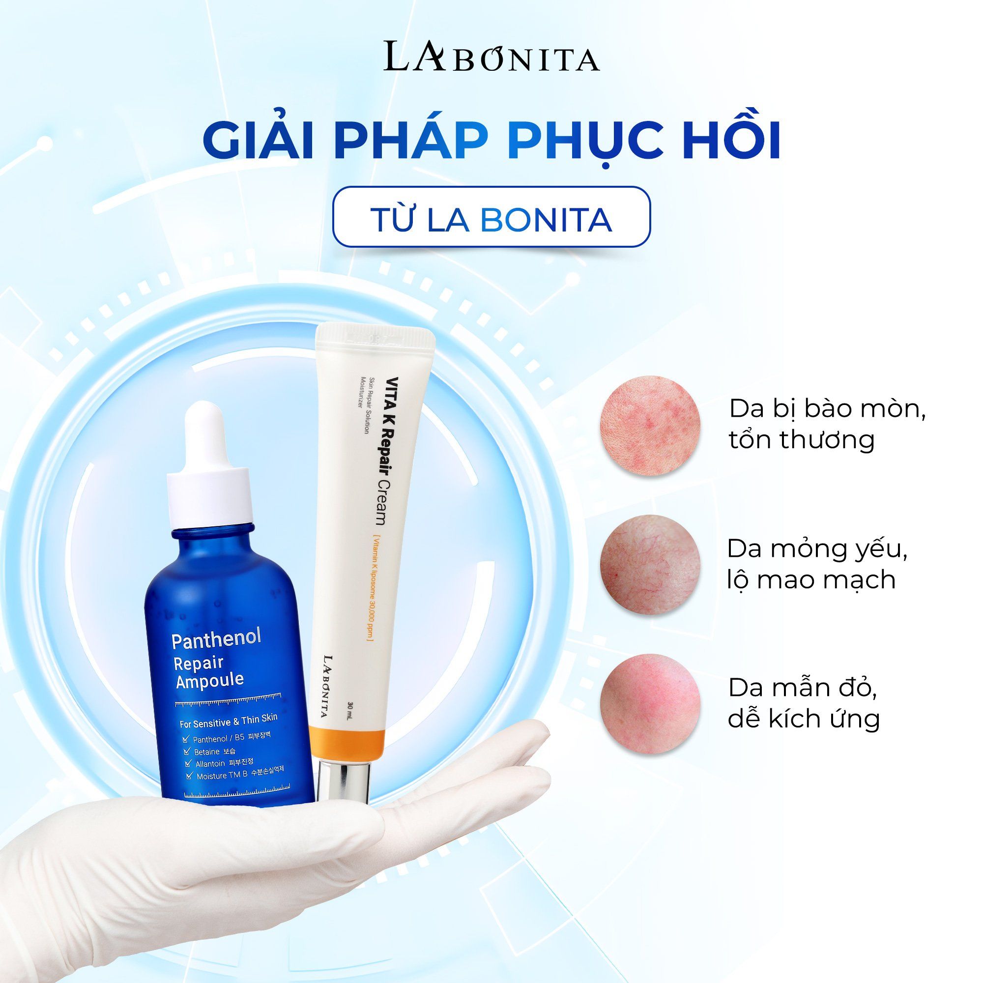 GIẢI PHÁP PHỤC HỒI TEO DA, GIÃN MAO MẠCH DO BÀO MÒN, TIỀN SỬ DA NHIỄM CORTICOID