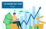 Lợi nhuận sau thuế: Cách tính, ý nghĩa & yếu tố ảnh hưởng