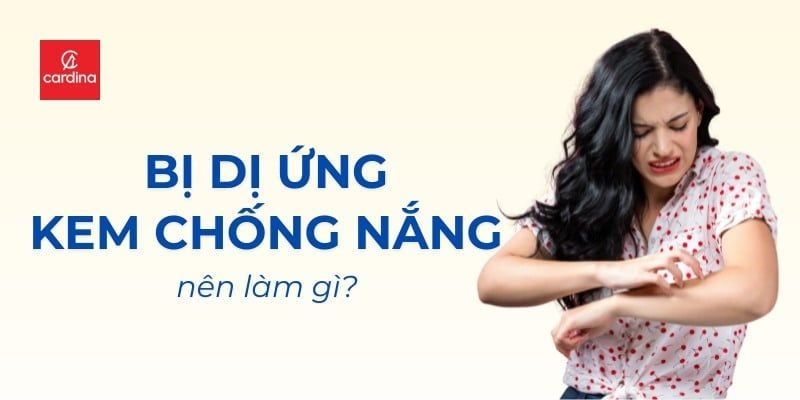 Lời khuyên từ bác sĩ: Làm gì khi dị ứng kem chống nắng?