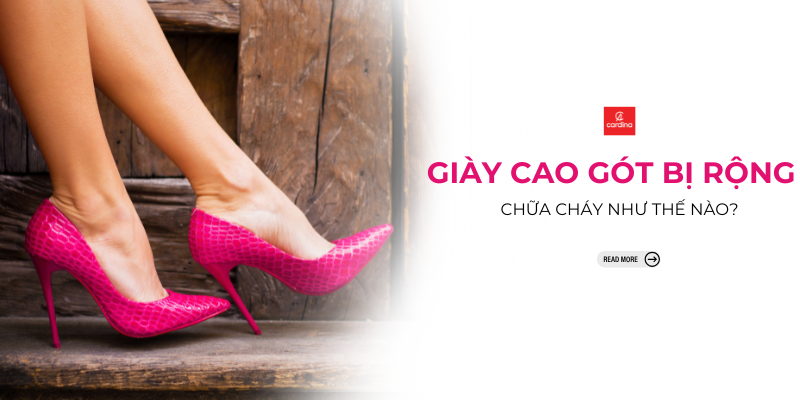 Giày Cao Gót Rộng Phải Làm Sao? Mẹo Xử Lý Đơn Giản, Nhanh Chóng
