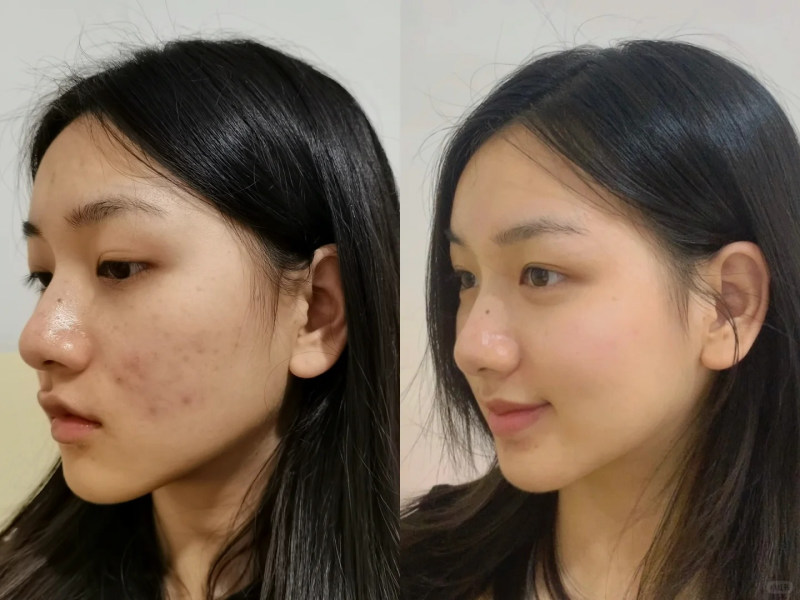 cách dùng dầu tẩy trang