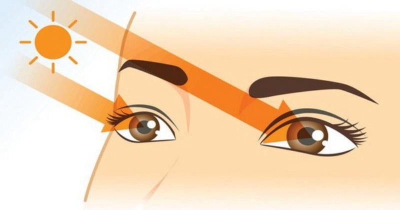 Tác hại nghiêm trọng của tia UV đối với đôi mắt