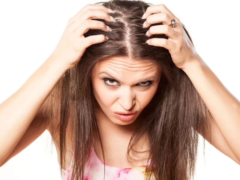 rụng tóc nhiều ở nữ tuổi 17 có sao không