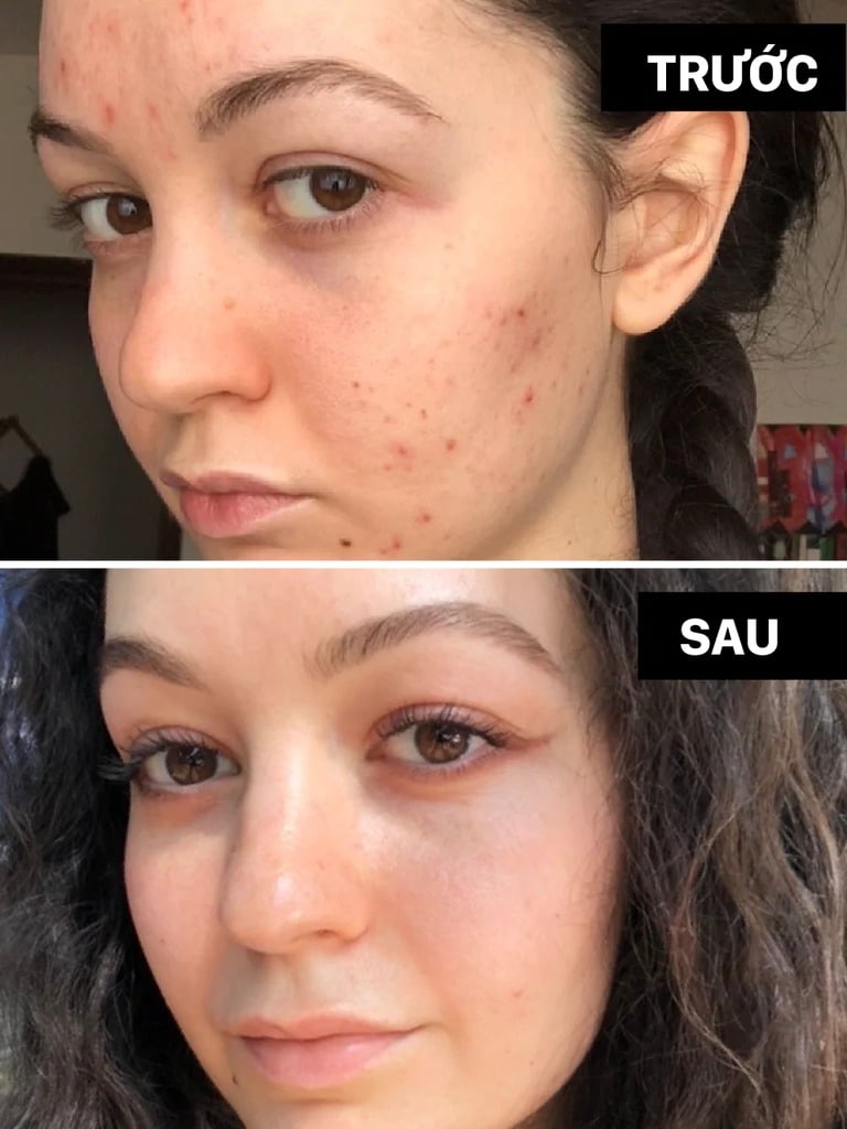 Treatment là gì?