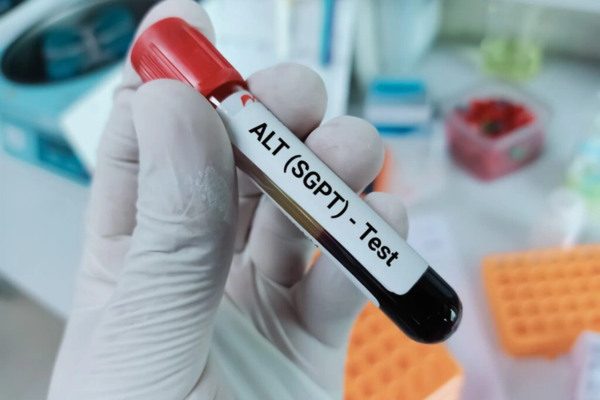 Chỉ số ALT (SGPT) trong máu là gì? Vai trò trong điều trị bệnh gan