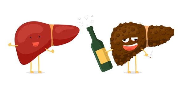 Bệnh gan nhiễm mỡ không do rượu