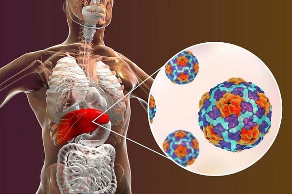 tác nhân gây ra bệnh viêm gan a là gì
