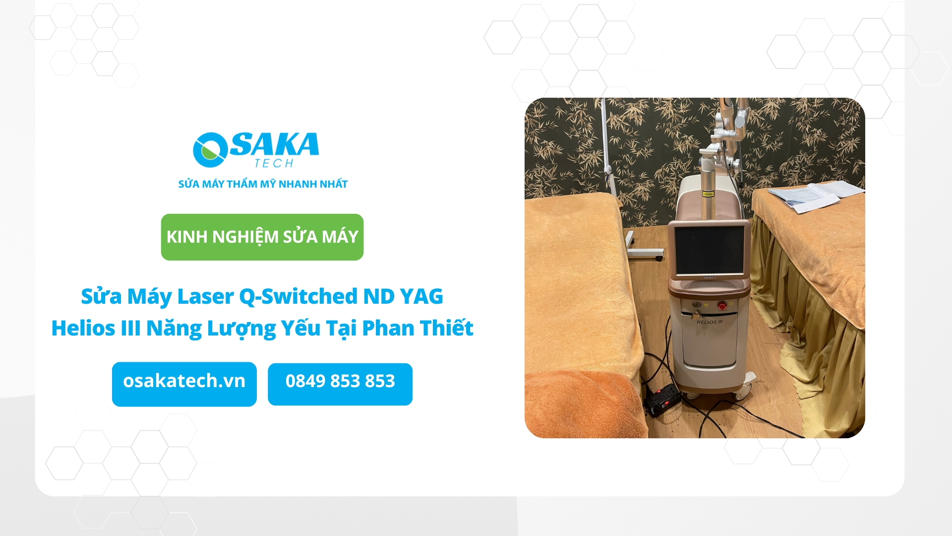 Sửa Máy Laser Q-Switched ND YAG Helios III Năng Lượng Yếu Tại Phan Thiết