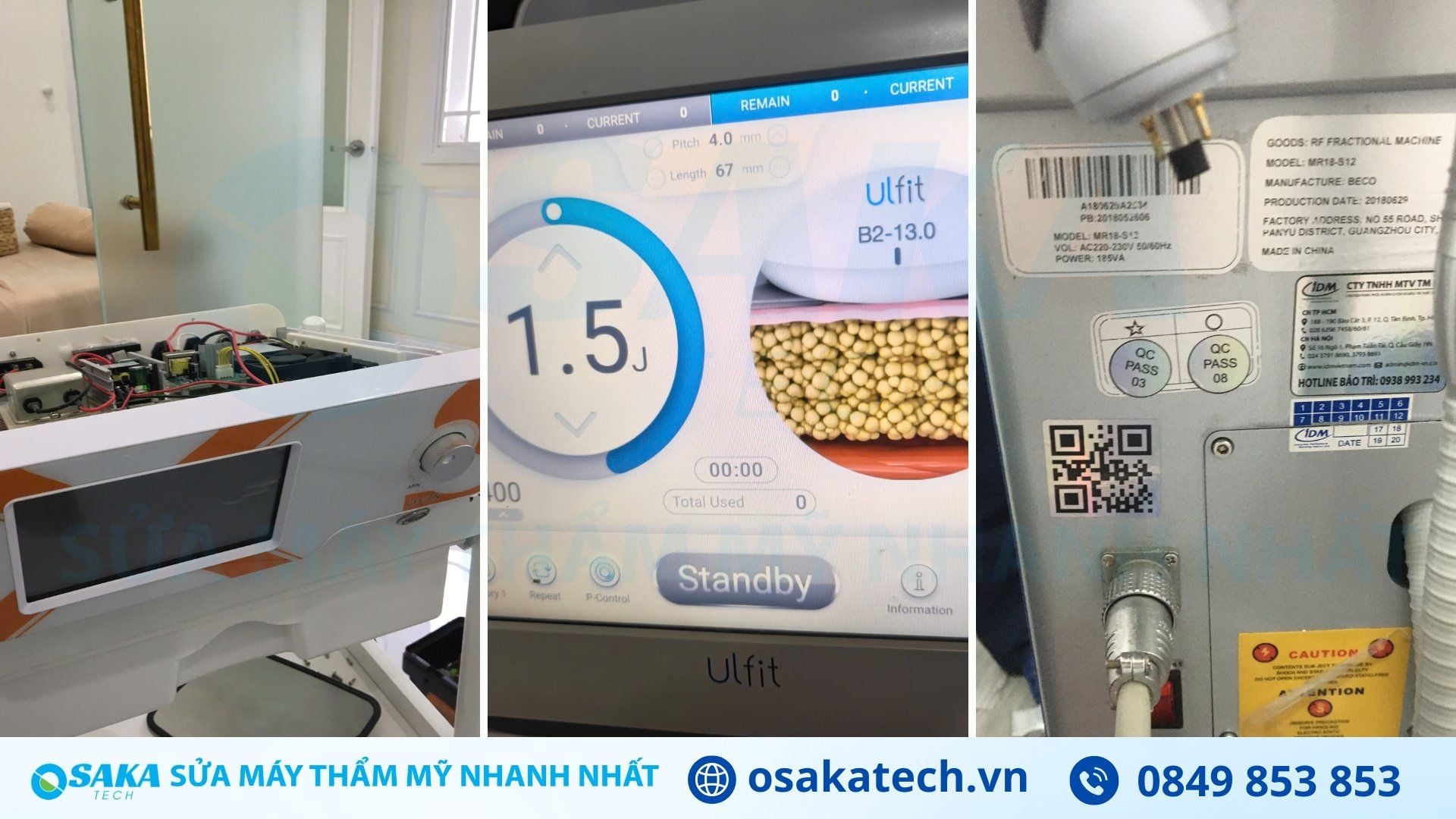 Lợi ích khi sửa máy nâng cơ