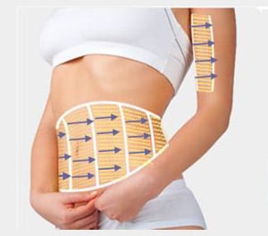 Máy nâng cơ SMAS HIFU