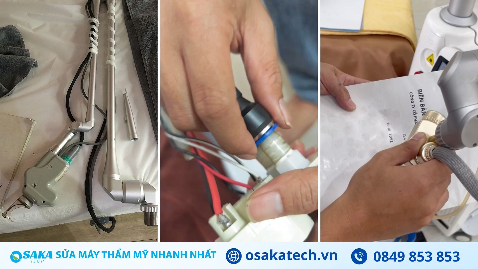 Lỗi máy trị sẹo thường gặp và cách khắc phục