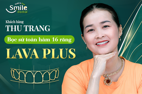 Chị Thu Trang làm 16 răng sứ Lava Plus cao cấp tại Nha khoa Smile