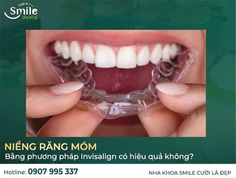 Niềng răng móm bằng phương pháp Invisalign có hiệu quả không?