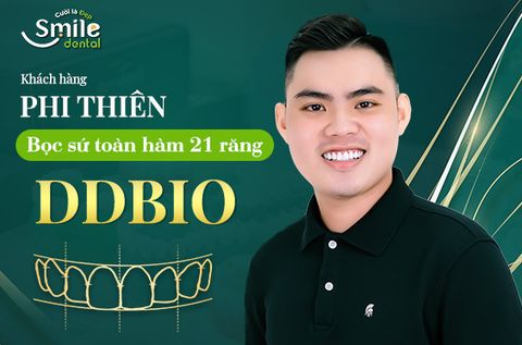Anh Trương Phi Thiên bọc 21 răng sứ DDBio tại Nha khoa Smile