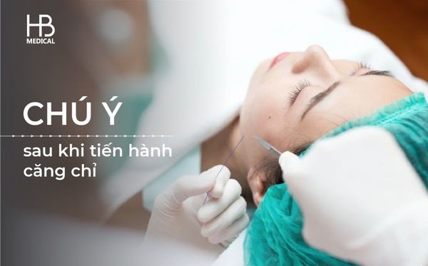 chú ý sau khi tiến hành căng chỉ