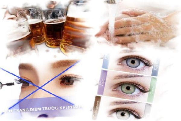 Người Thực Hiện Phẫu Thuật Mổ Mắt Cận Có Bị Tái Lại Không ?