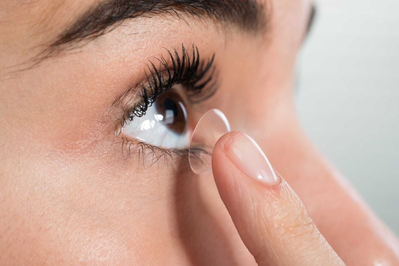 Kính áp tròng cho người loạn thị đảm bảo tính thẩm mỹ, tiện lợi