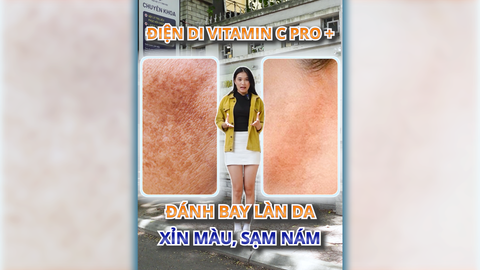 Đánh bay làn da xỉn màu cùng “Điện di vitamin C Pro+”!