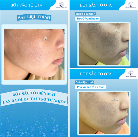 BỚT SẮC TỐ OTA!