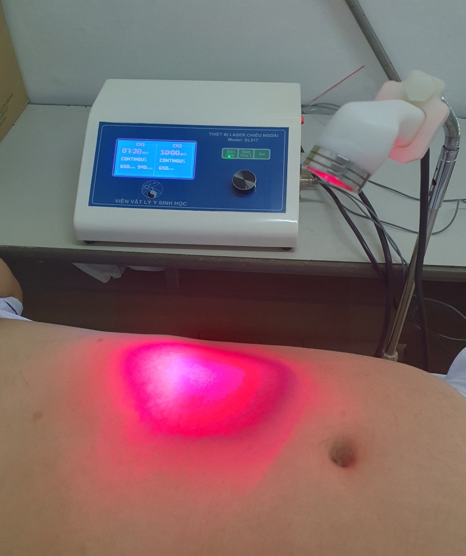 Hiệu quả của laser hai bước sóng trong điều trị bệnh Zona