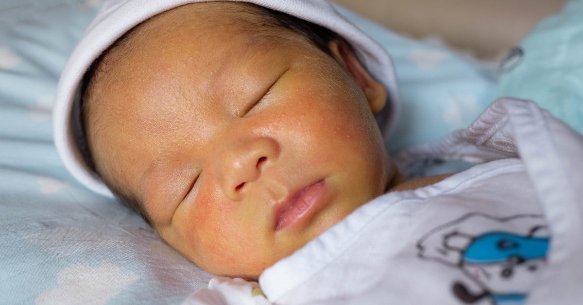 Bố mẹ cần phân biệt được vàng da sinh lý và vàng da bệnh lý ở trẻ
