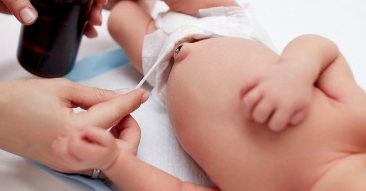 Rốn là vùng da nhạy cảm nên cần thật sự nhẹ nhàng và chú ý vệ sinh