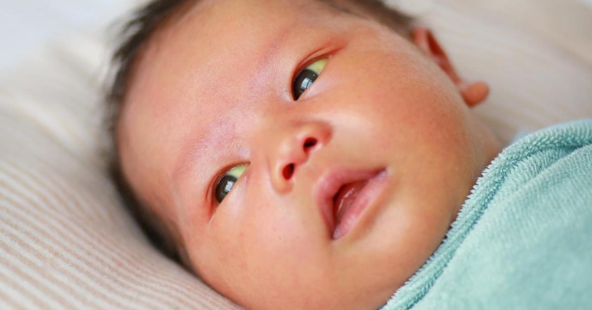 Có nhiều biện pháp mà bố mẹ có thể cải thiện tình trạng vàng da ở trẻ