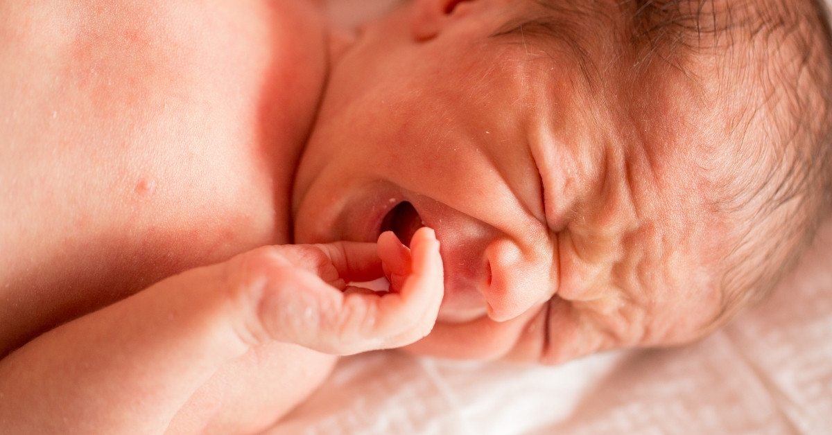 Đau bụng, khó tiêu hoặc các vấn đề liên quan đến tiêu hóa có thể làm trẻ khóc dạ đề
