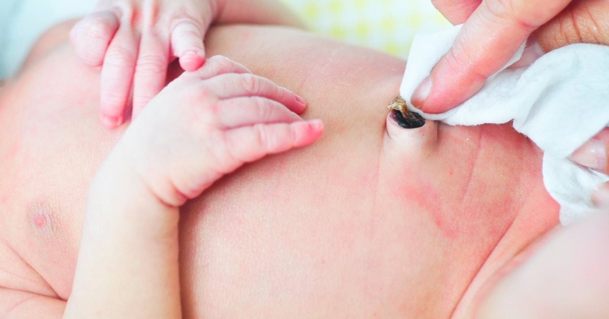 Vệ sinh rốn vừa ngăn chặn nhiễm trùng vừa thúc đẩy quá trình rụng rốn nhanh hơn