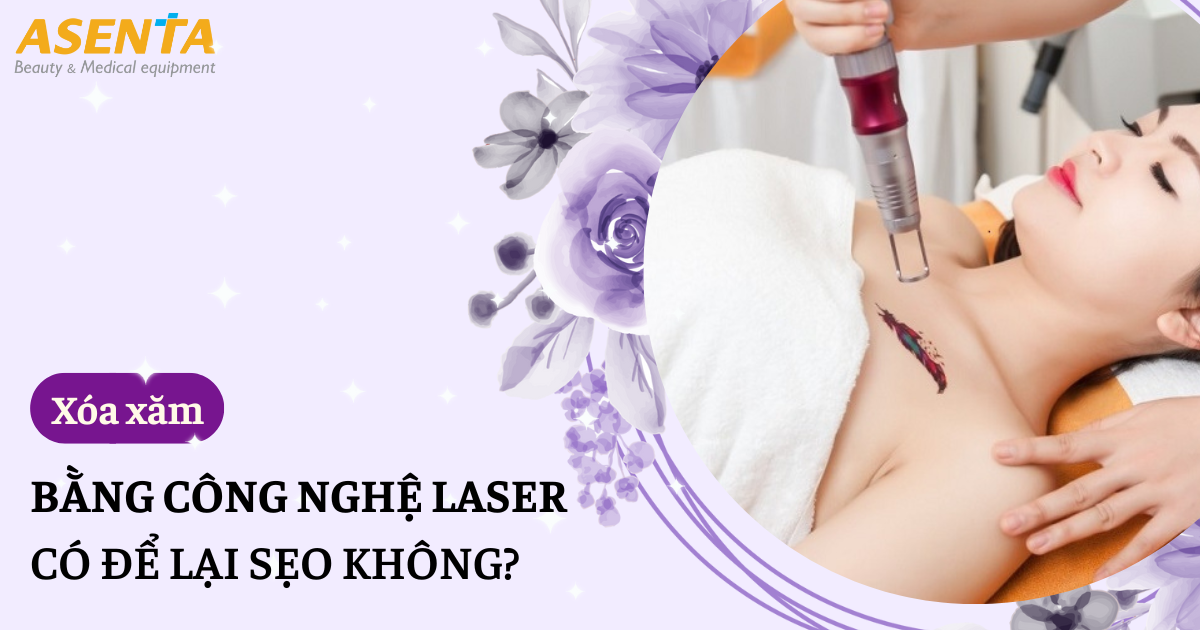 Công Nghệ Xóa Xăm Không Sẹo Bằng Laser Là Gì?