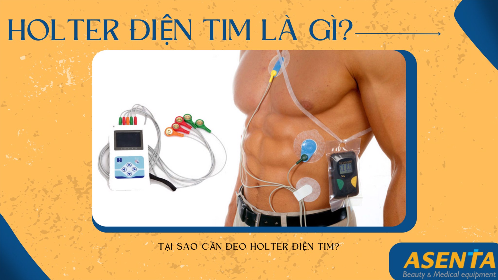 Holter điện tim là gì? tại sao cần đeo holter điện tim