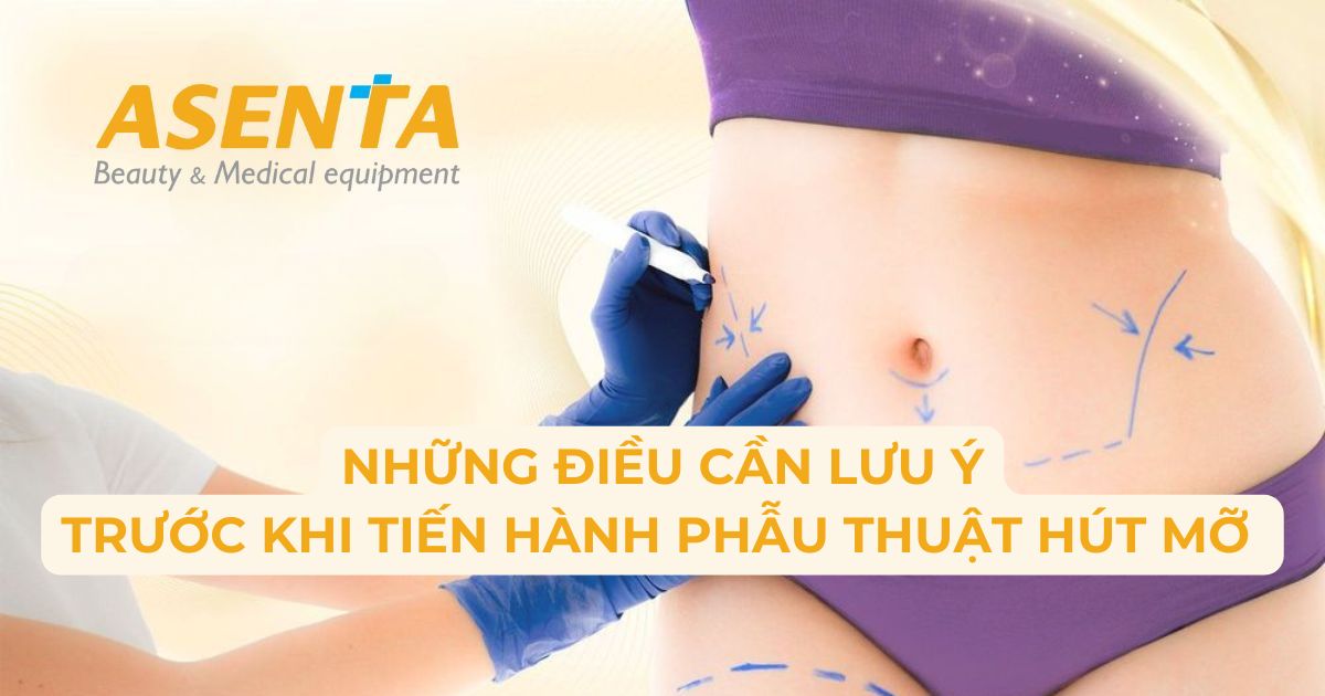 NHỮNG ĐIỀU CẦN LƯU Ý TRƯỚC KHI PHẪU THUẬT HÚT MỠ