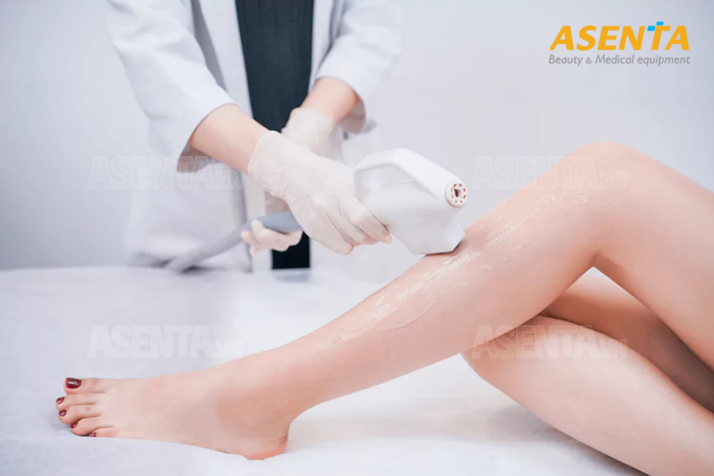 Đầu tư máy triệt lông có lời không? Chi phí – lợi nhuận – thời gian hoàn vốn