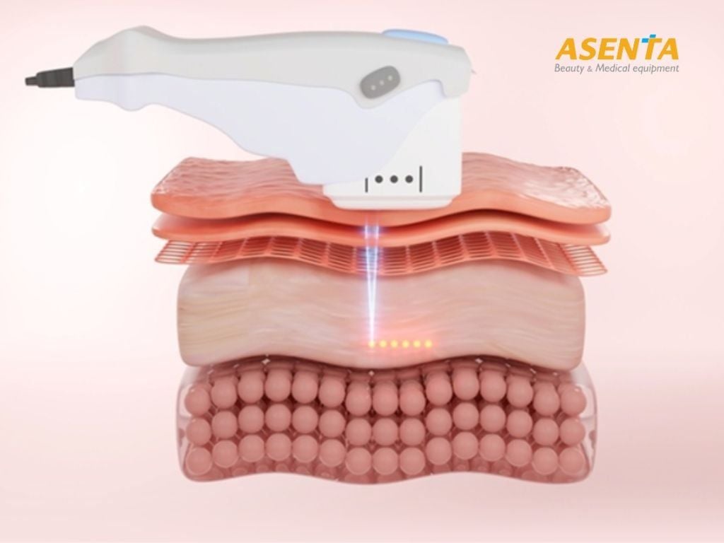 Cơ chế hoạt động khi Dùng sóng siêu âm hội tụ HIFU