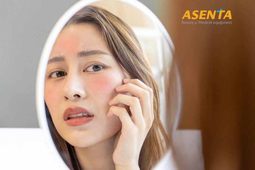 Sử dụng laser điều trị tái tạo da có thể gây ra tác dụng phụ không mong muốn
