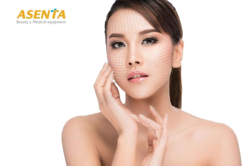 Có hai loại chỉ sinh học thường dùng trong căng chỉ da mặt.