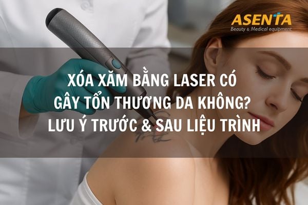 Xóa xăm bằng laser có đau không