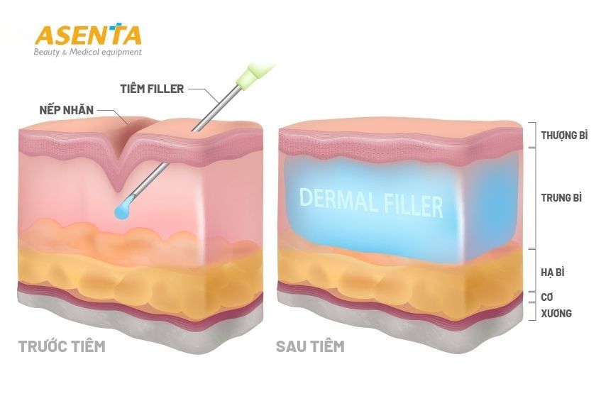 Cấu tạo của da rất phức tạp